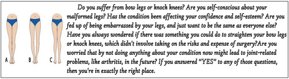 Bow Legs No More